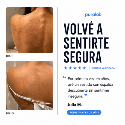 Puralab®  – Acné Corporal
