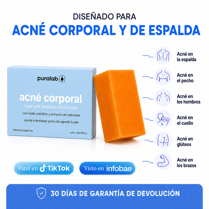 Puralab®  – Acné Corporal